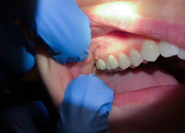 Best Urgent Dental Care in Hanscom Af, MA